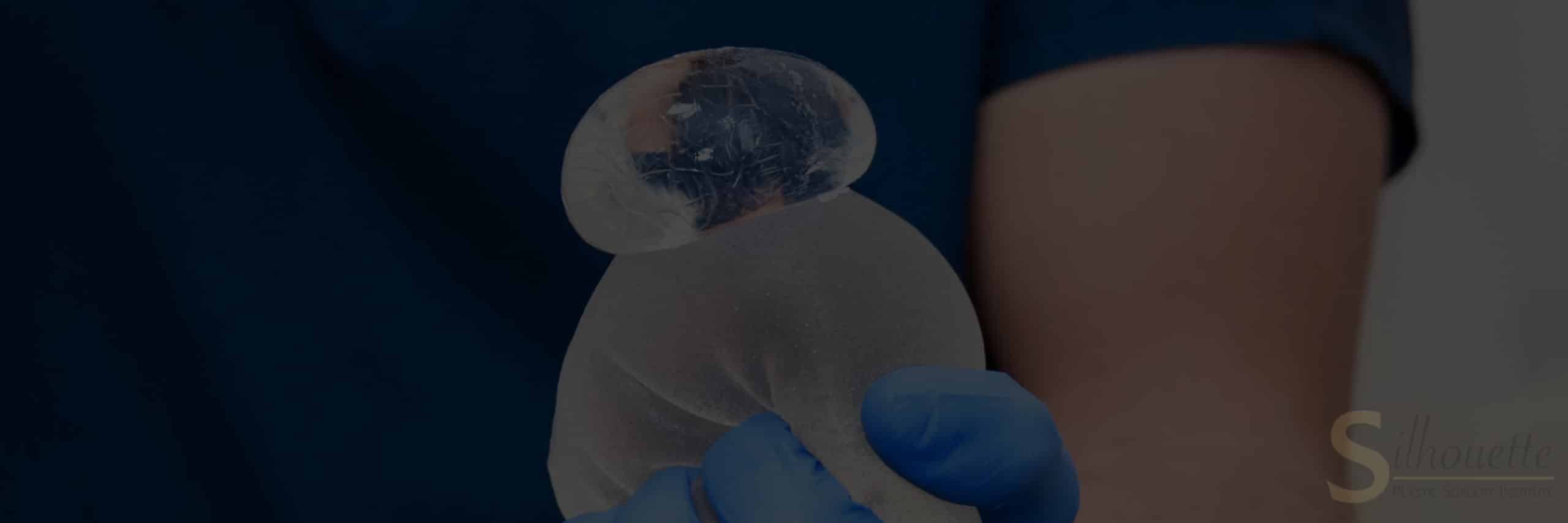 breast implant removal surgery