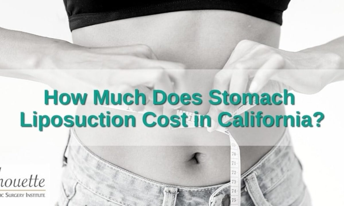 How Much Does Stomach Liposuction Cost in California?