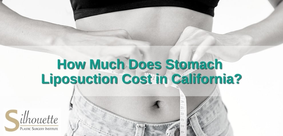 how much does stomach liposuction cost in california