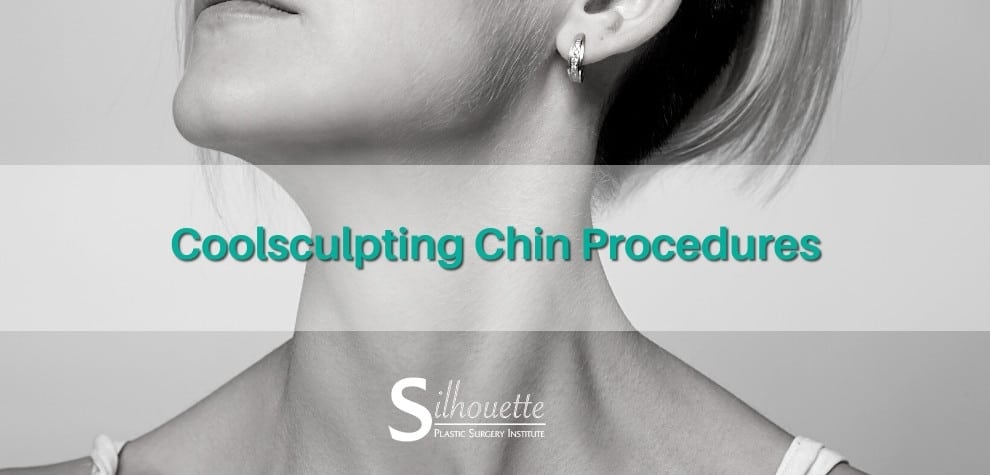 coolsculpting for double chin