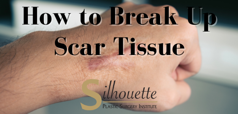how to break up scar tissue