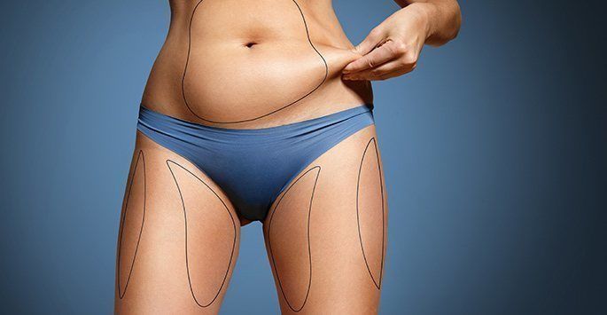 fat transfer body contouring