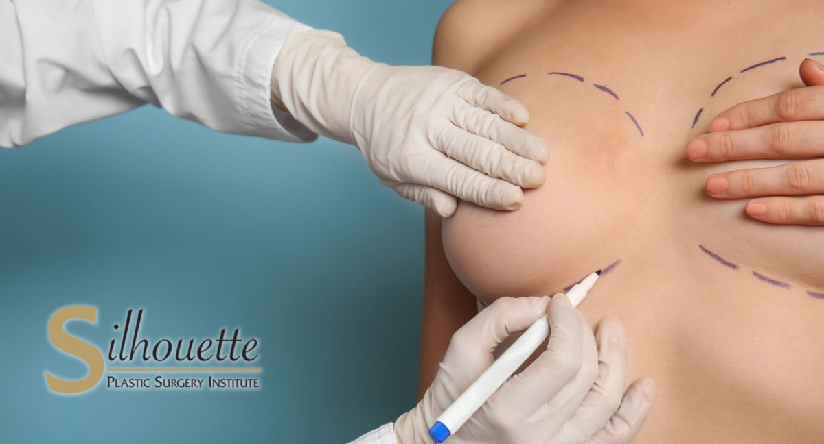 areola reduction surgery