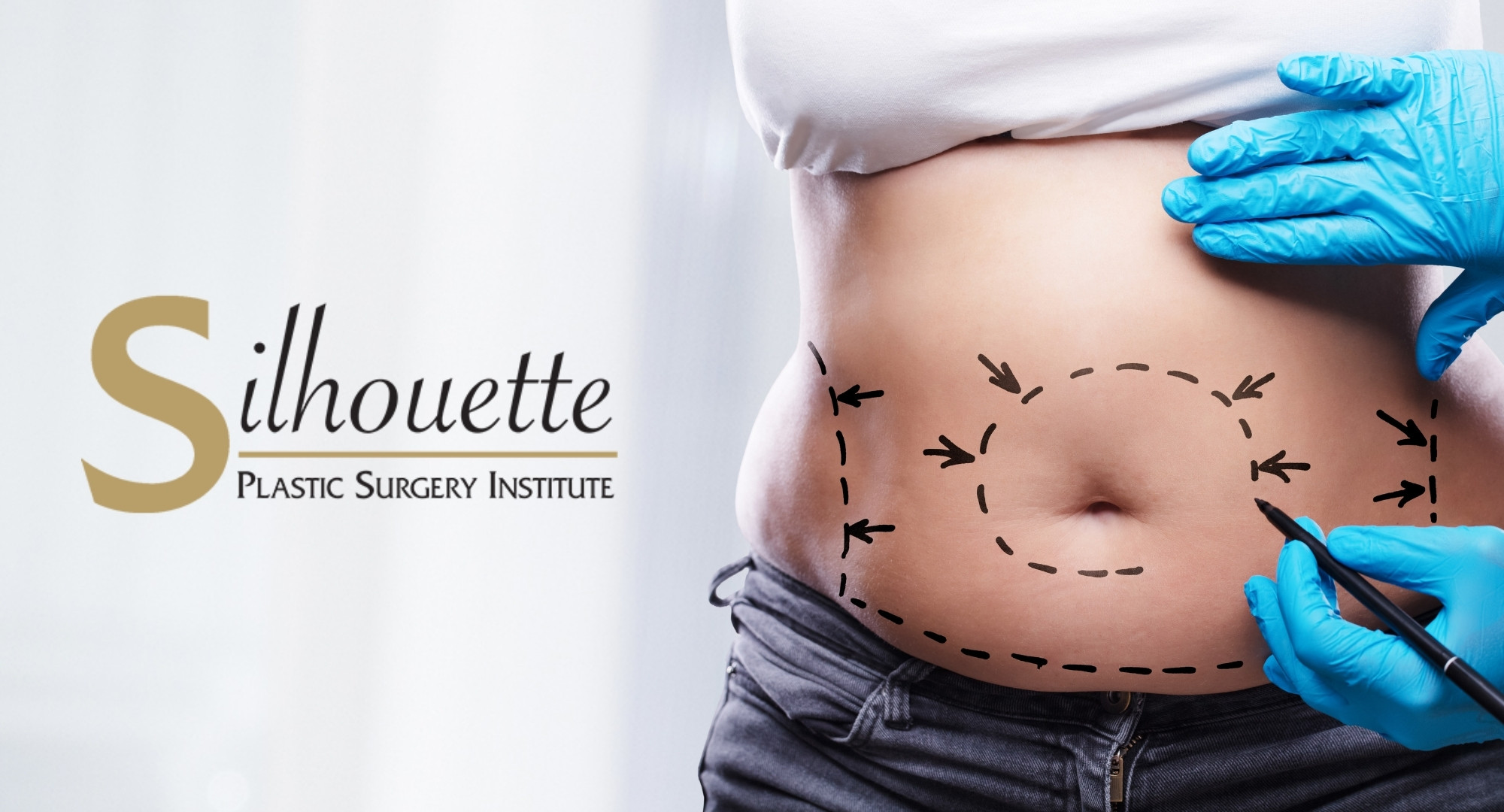 Tummy Tuck Recovery  Cosmetic Plastic Surgery Institute