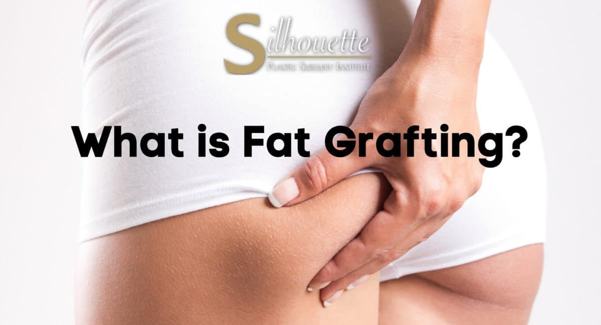 What is Fat Grafting