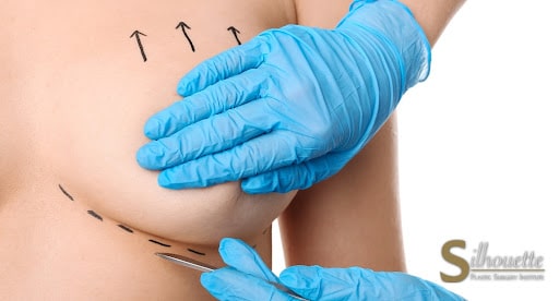 C Cup Boobs  Gold Coast Plastic Surgery