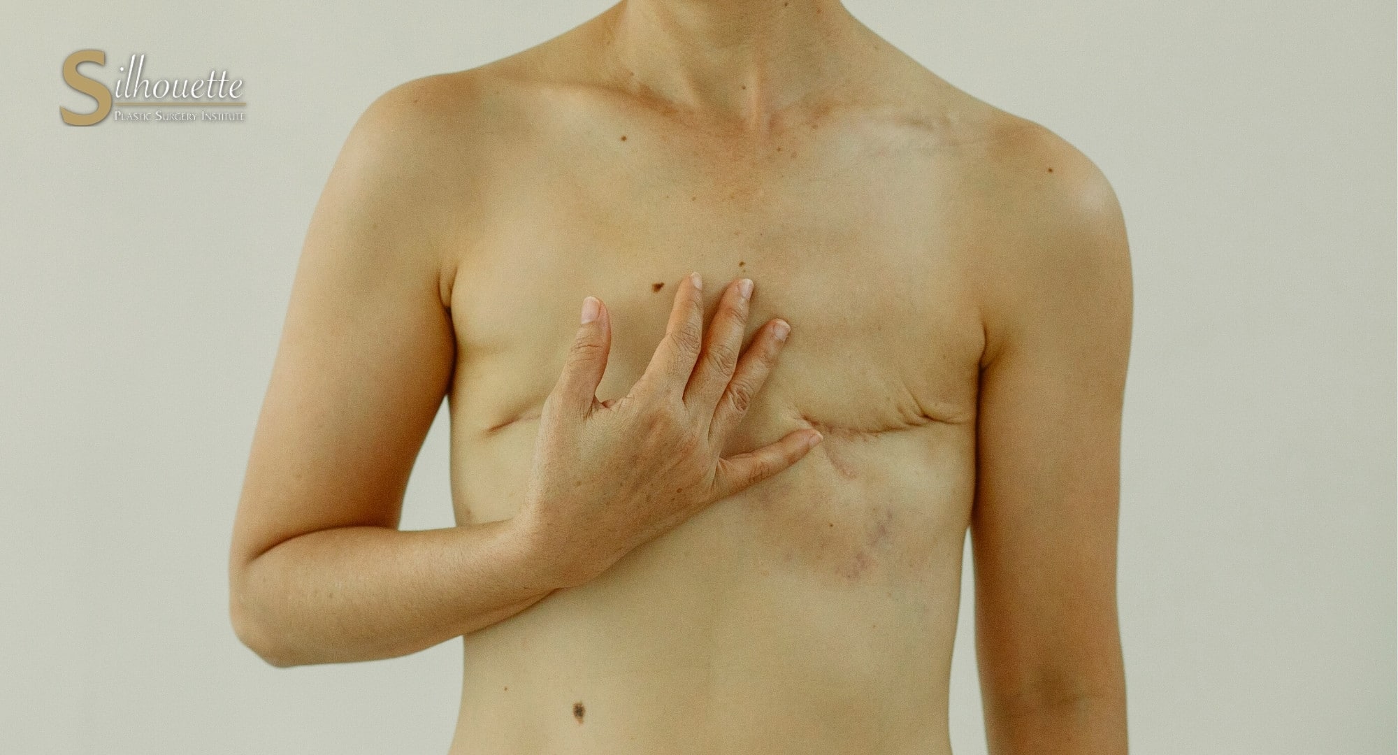 Skin-sparing mastectomy with teardrop cut
