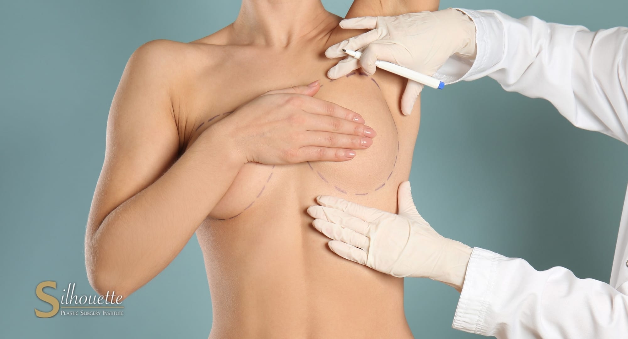 Breast Reduction (Reduction Mammoplasty)