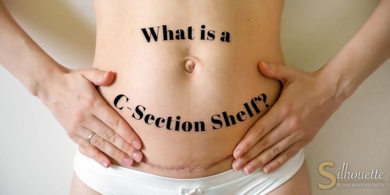 c section shelf
