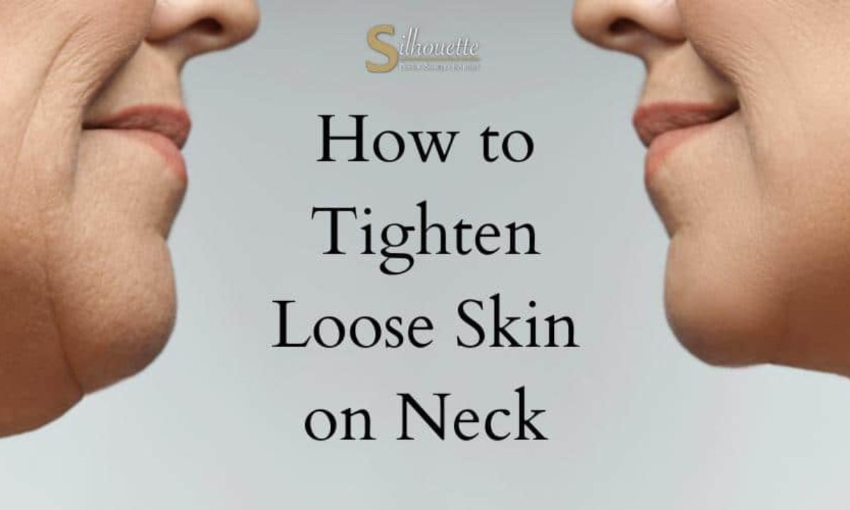 https://silhouetteplasticsurgery.com/wp-content/uploads/2023/01/How-to-Tighten-Loose-Skin-on-Neck-1200x720.jpg