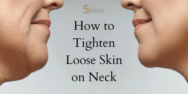 How to Tighten Loose Skin on Neck