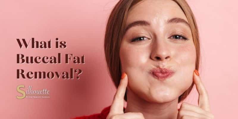 What is Buccal Fat Removal