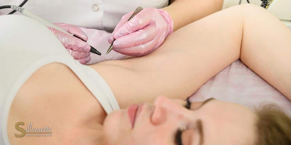 difference between electrolysis and laser hair removal