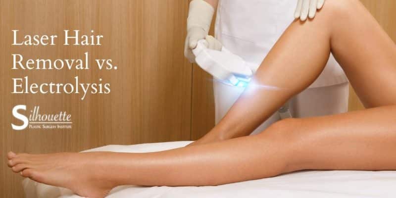 laser hair removal vs electrolysis