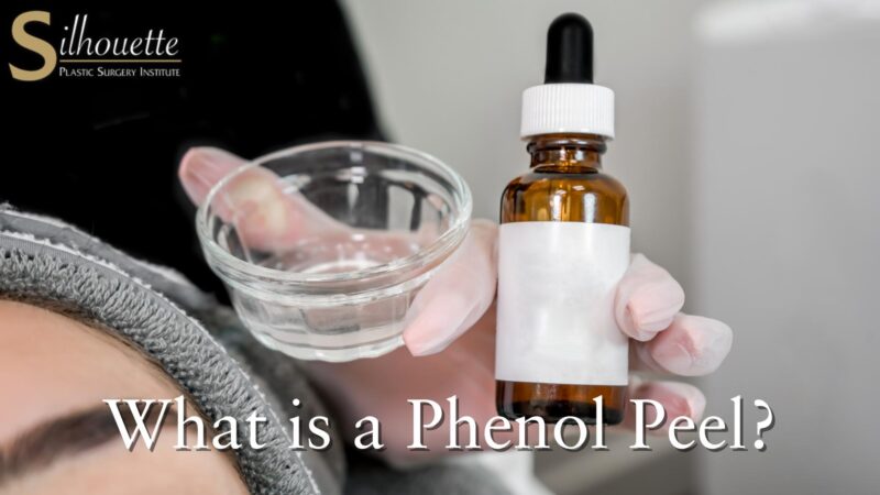 What is a Phenol Peel
