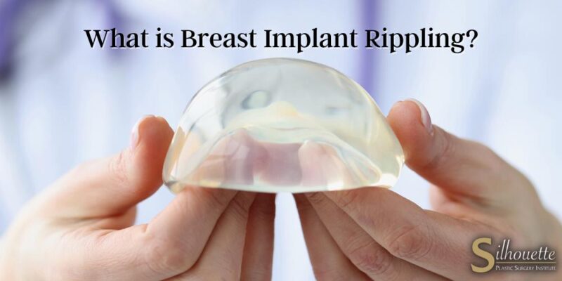 breast implant rippling