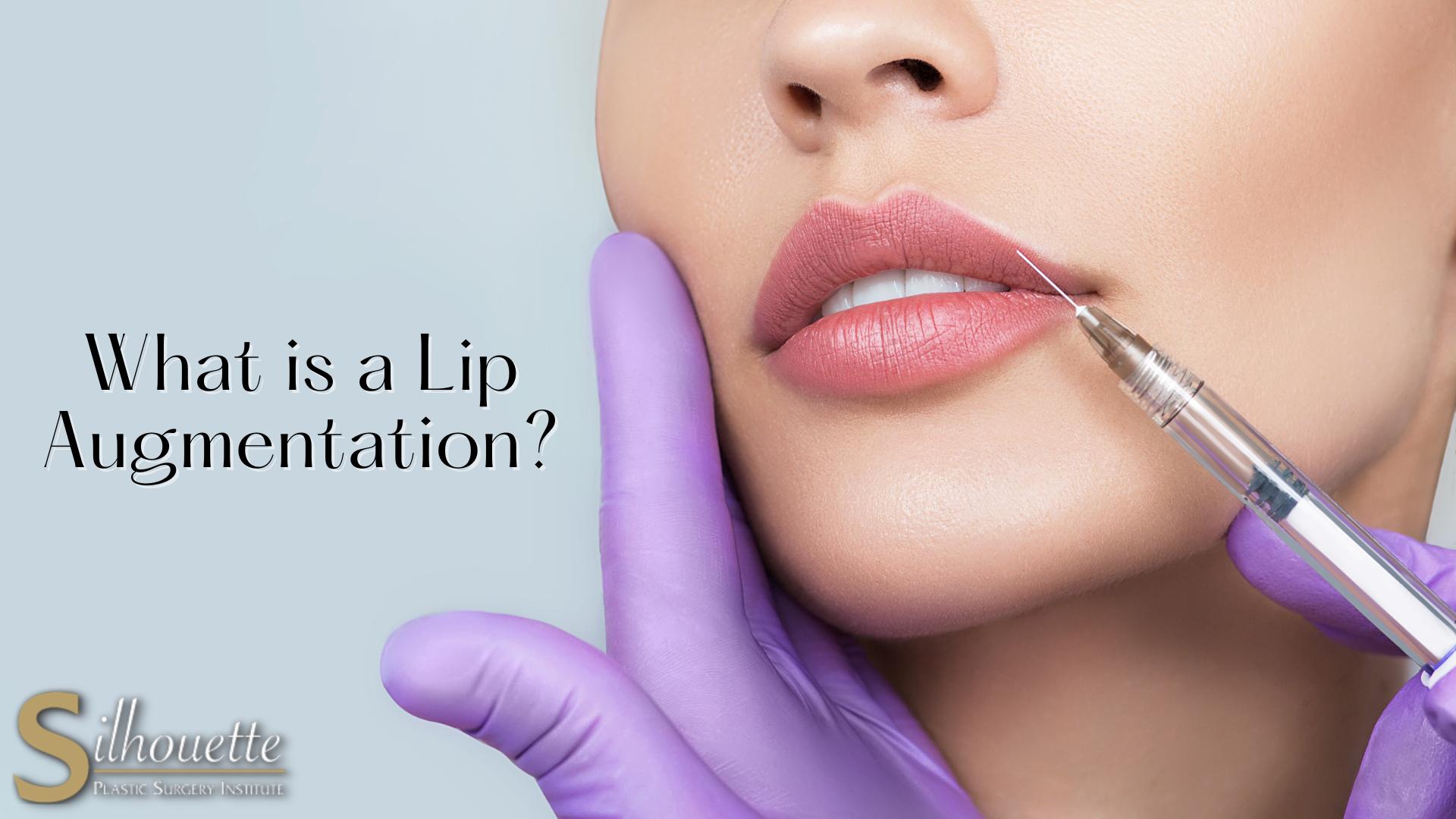 What is a Lip Augmentation?  Silhouette Plastic Surgery Institute