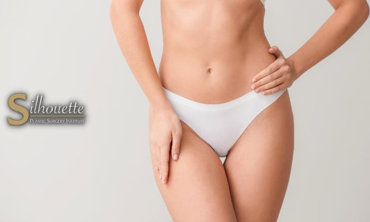 Mons Pubis Reduction Plastic Surgery at Low cost