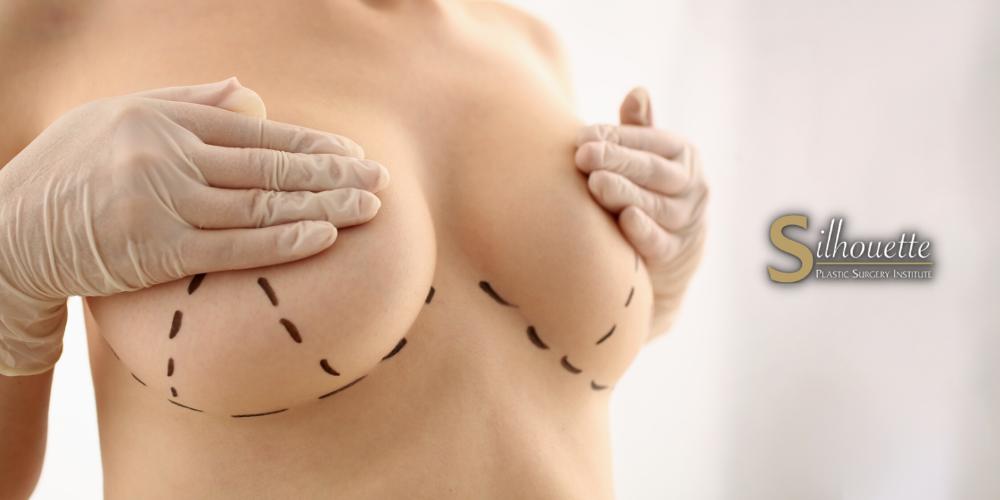 losing weight with breast implants
