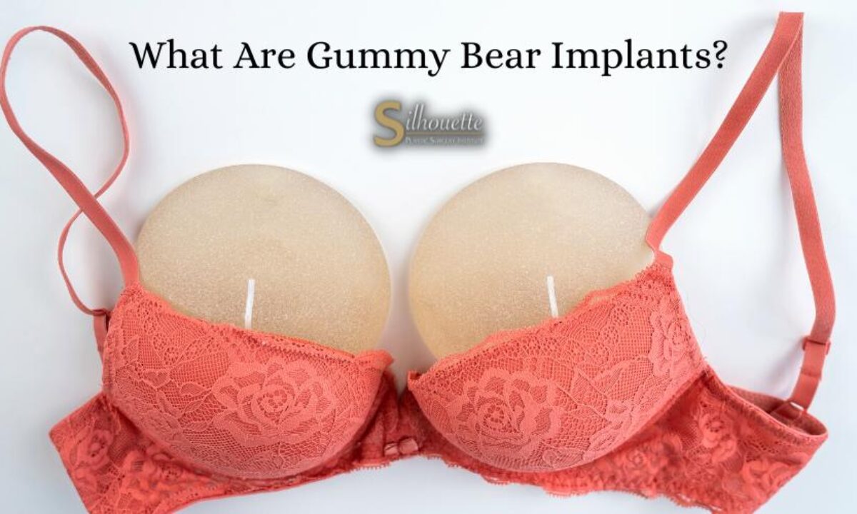 Gummy Bear Implants vs Regular Implants