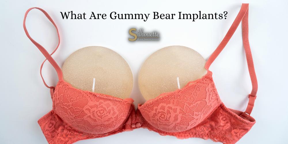 What Are Gummy Bear Implants?