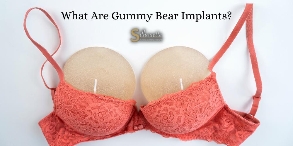 Gummy Bear Breast Implants San Diego Augmentation