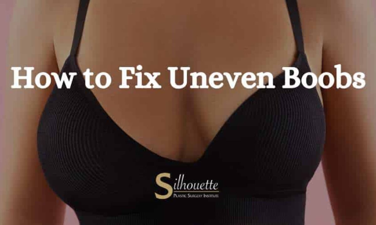 How to Fix Uneven Boobs | Breast Asymmetry Correction California