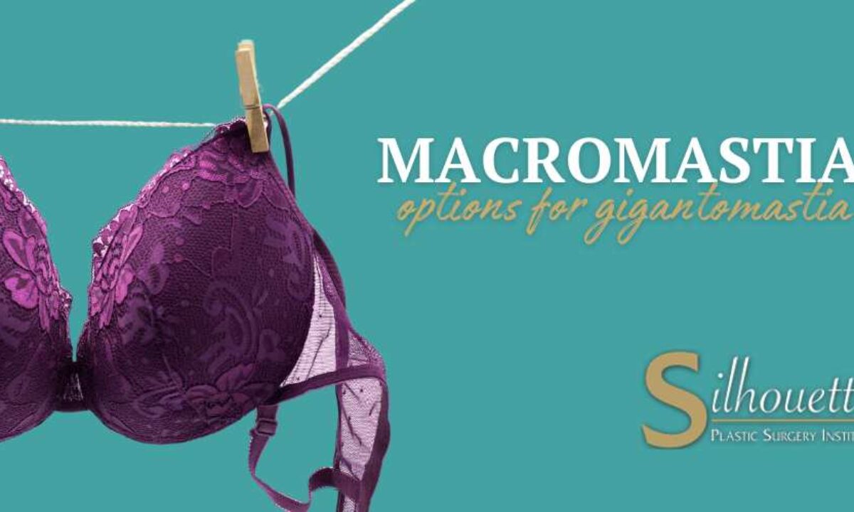 macromastia Macromastia Treatment | Causes and Treatment for Gigantomastia
