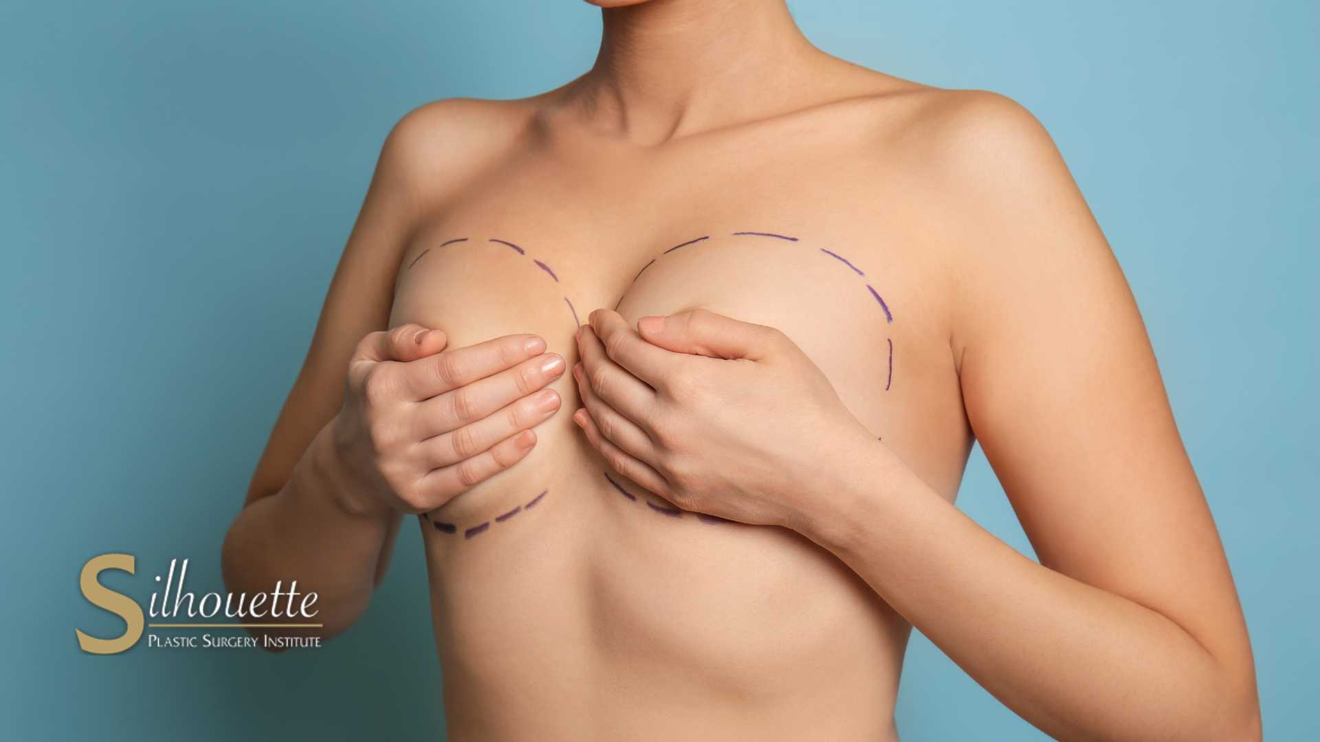 Breast Lift Surgery Foothill Ranch